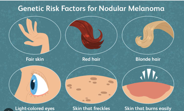 Основные факторы риска развития меланомы